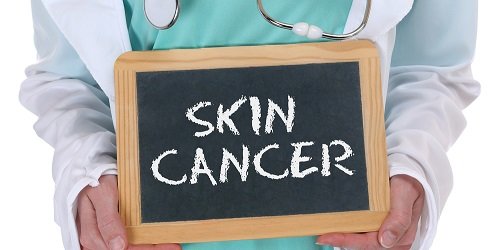skin-cancer-dr